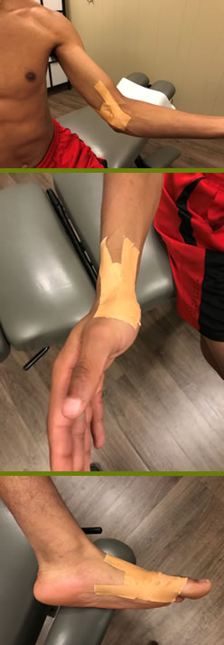 Leukotape Taping