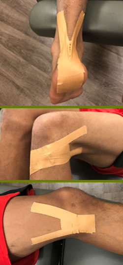 Leukotape Taping